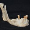 4 Mascella Con Dentatura Deteriorata (1)
