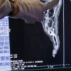 7. Immagini 3D del piede mummificato durante l_esame tomografico